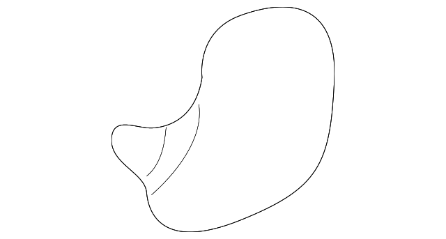 9151668 Деталь SIDE RAIL CAP
