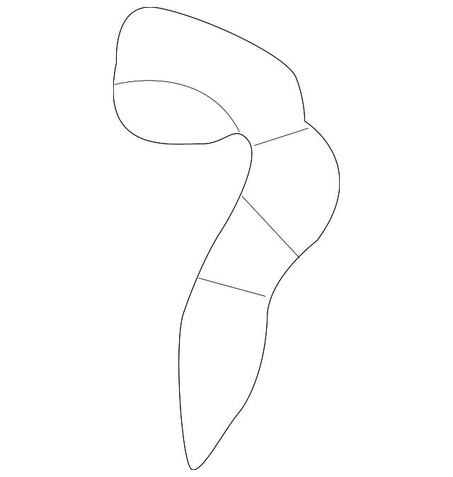 21019615 Деталь BRACKET